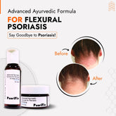 Flexural Psoriasis Skin Treatment | Best Natural Ayurvedic Solutions for Flexural Psoriasis