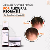 Flexural Psoriasis Skin Treatment | Best Natural Ayurvedic Solutions for Flexural Psoriasis