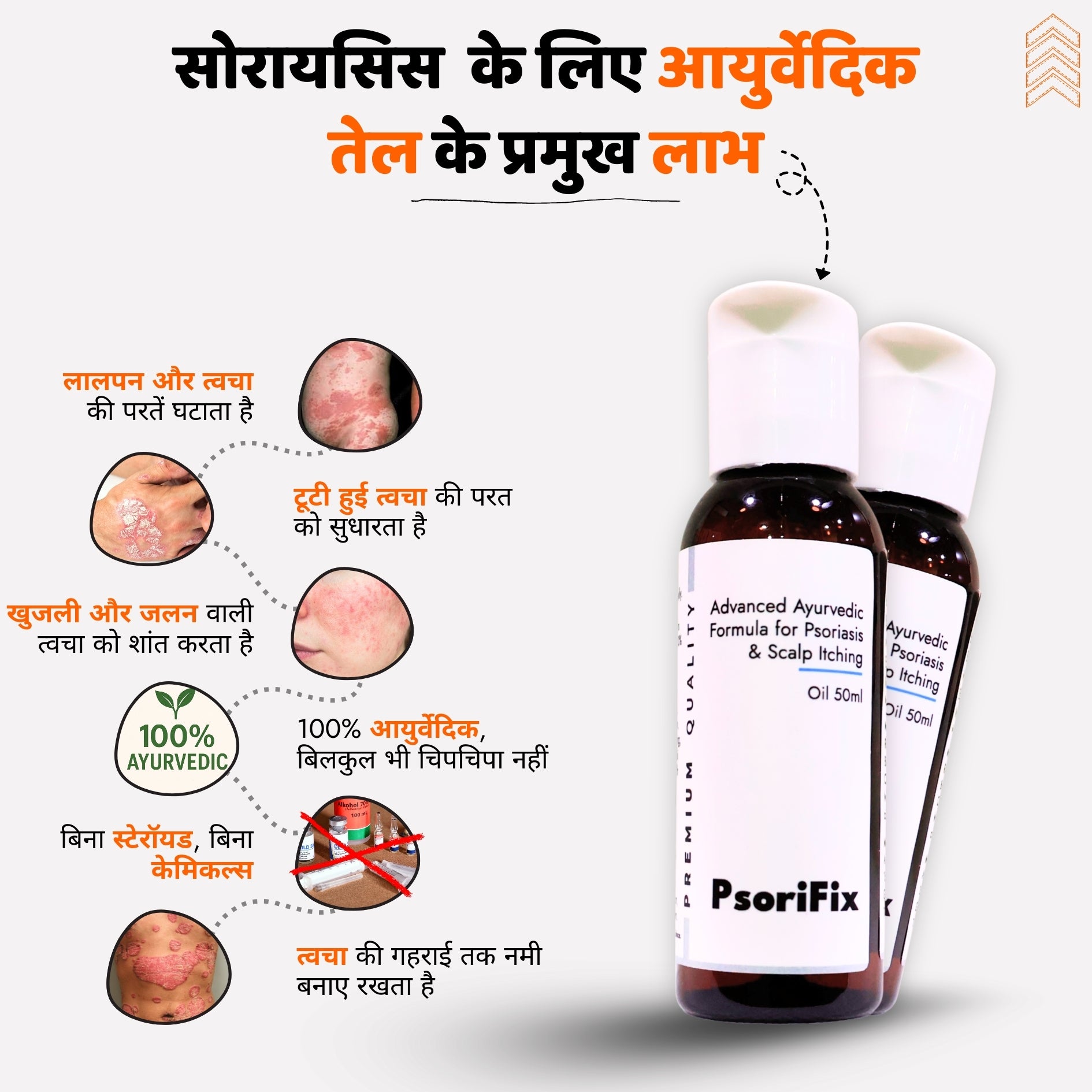सोरायसिस व खुजली के लिए आयुर्वेदिक प्राकृतिक तेल (दिन के उपयोग के लिए)