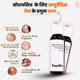 सोरायसिस व खुजली के लिए आयुर्वेदिक प्राकृतिक तेल (दिन के उपयोग के लिए)